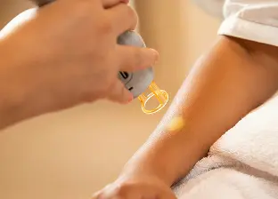 Microneedling Transformation